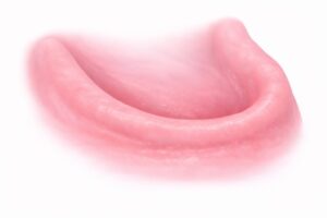 restauration dentaire total